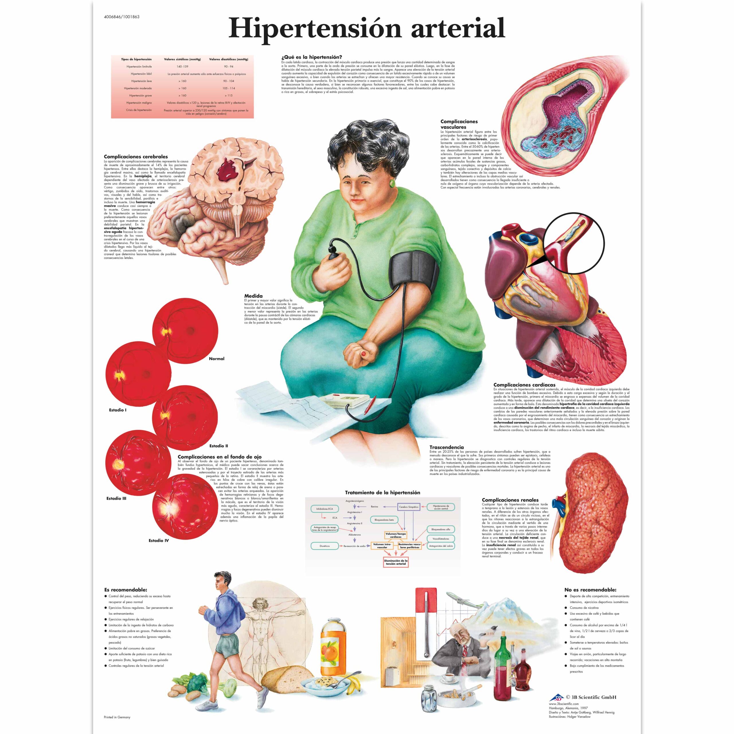 Hipertensión arterial Lámina Anatomical D