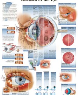 Enfermedades del Ojo