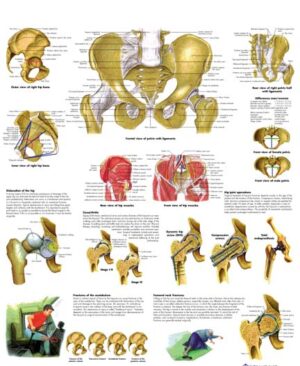 Pelvis y Cadera- Anatomia y Patología