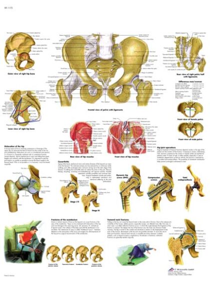 Pelvis y Cadera- Anatomia y Patología