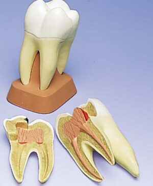 Molar superior de tres raíces, 2 piezas