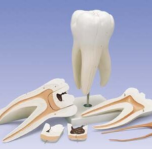 Molar superior, 6 piezas