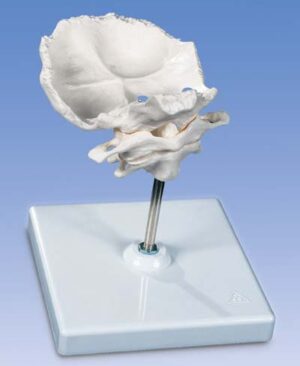 Atlas y axis con lamina horizontal del occipital Montado sobre s