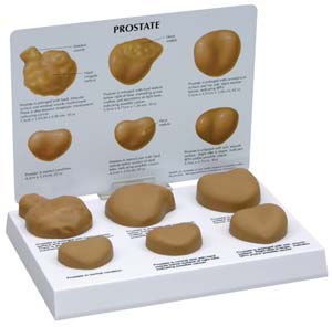 Prostata