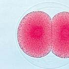 La Embriología del Erizo de Mar (Psammechinus miliaris) - españo