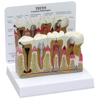 Modelo de dientes