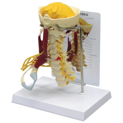 Columna cervical con músculos de lujo