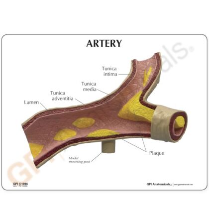 Modelo de arteria - Image 2