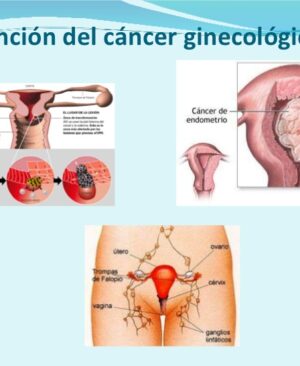 Ginecologicos