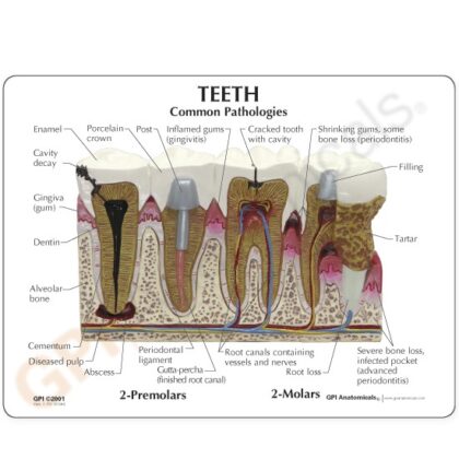 Modelo de dientes - Image 3