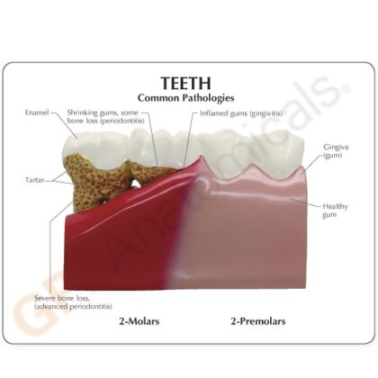 Modelo de dientes - Image 4