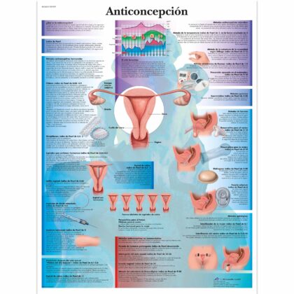 Anticoncepción Lámina