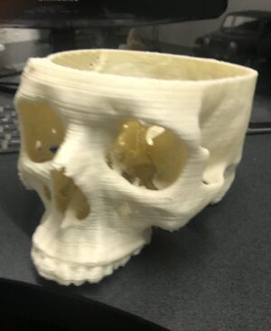 Impresiones medicas en 3D