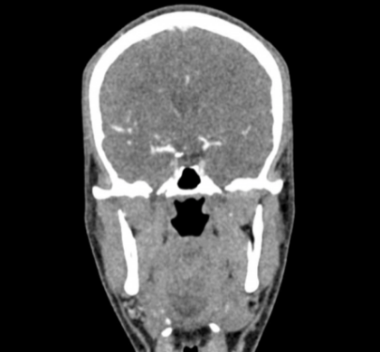 Phantom de cabeza y cuello para TC, rayos X y radioterapia - Image 5