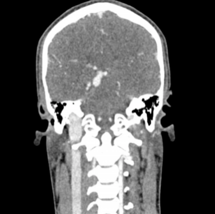 Phantom de cabeza y cuello para TC, rayos X y radioterapia - Image 10